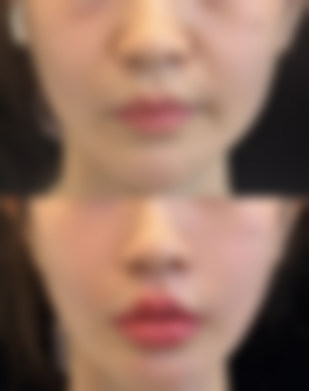 八、海口添美整形美容诊所真实的顾客评价如下：