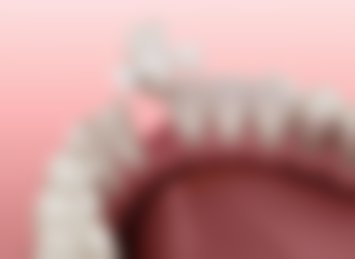 海口爱牙口腔医院矫正牙齿:精良技术助力