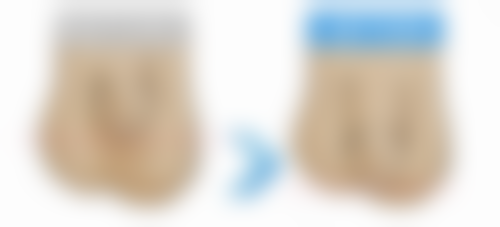 七、宝鸡高新开发区爱容妍医疗美容门诊部真实的顾客评价如下：