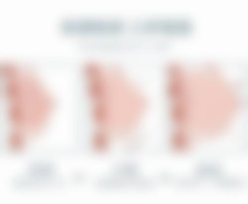 五、郑州金水代淑媛整形医疗美容医院实例