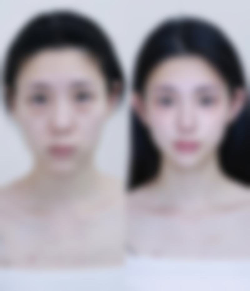 四、深圳天爱医疗美容诊所实例