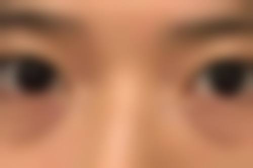 四、安徽省第二人民医院烧伤整形科、囗腔科实例