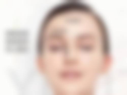 江河牙冠修复实例