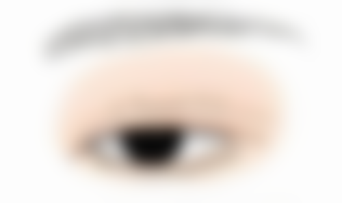 修复手术的注意事项