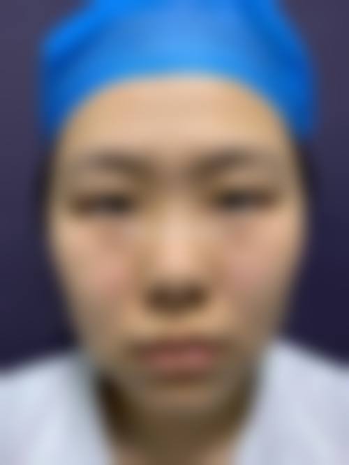 李学刚在哪家医院