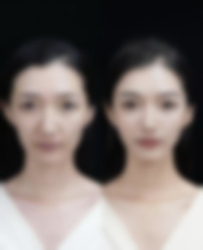 七、广西 南宁东方整形美容医院真实的顾客评价如下: