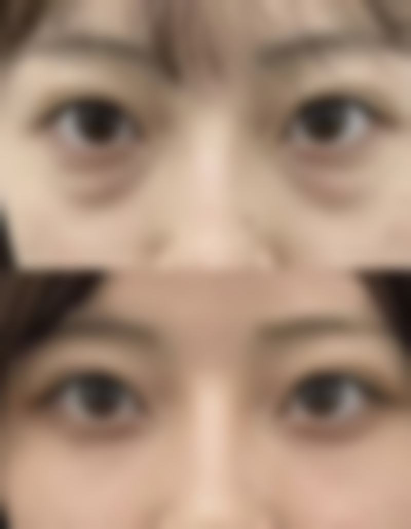 李学刚怎么预约?