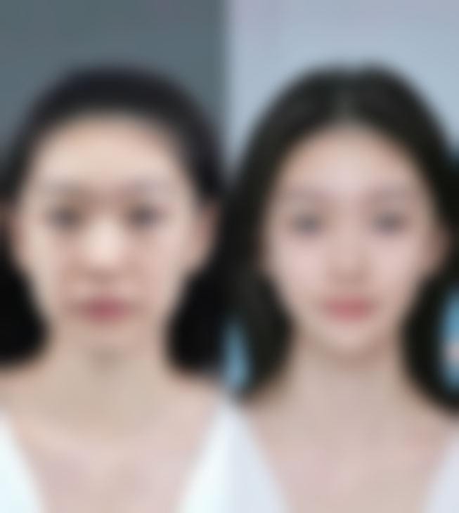 四、延吉金文整形医学美容诊所实例