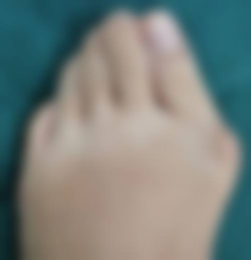 六、株洲市一医院烧伤整形外科怎么预约：