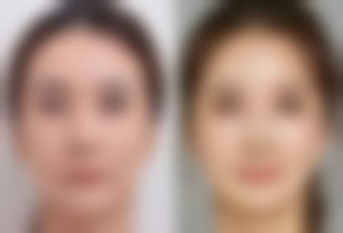 八、芜湖爱容医疗美容门诊部真实的顾客评价如下：