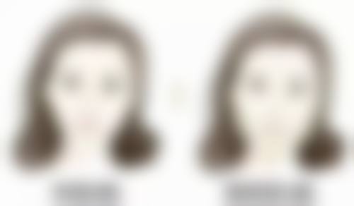 七、韩国Ready整形外科价格表:(仅供参考)