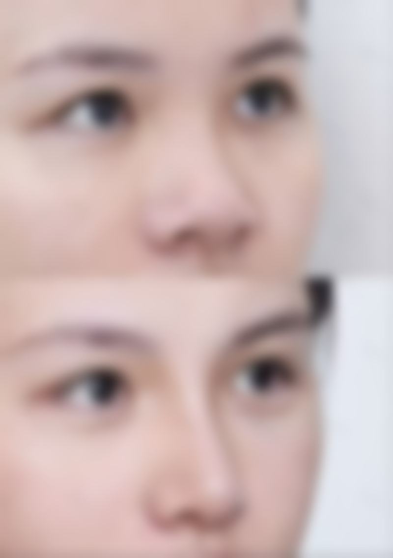 小孩积食眼袋深怎么办？日常护理要注意