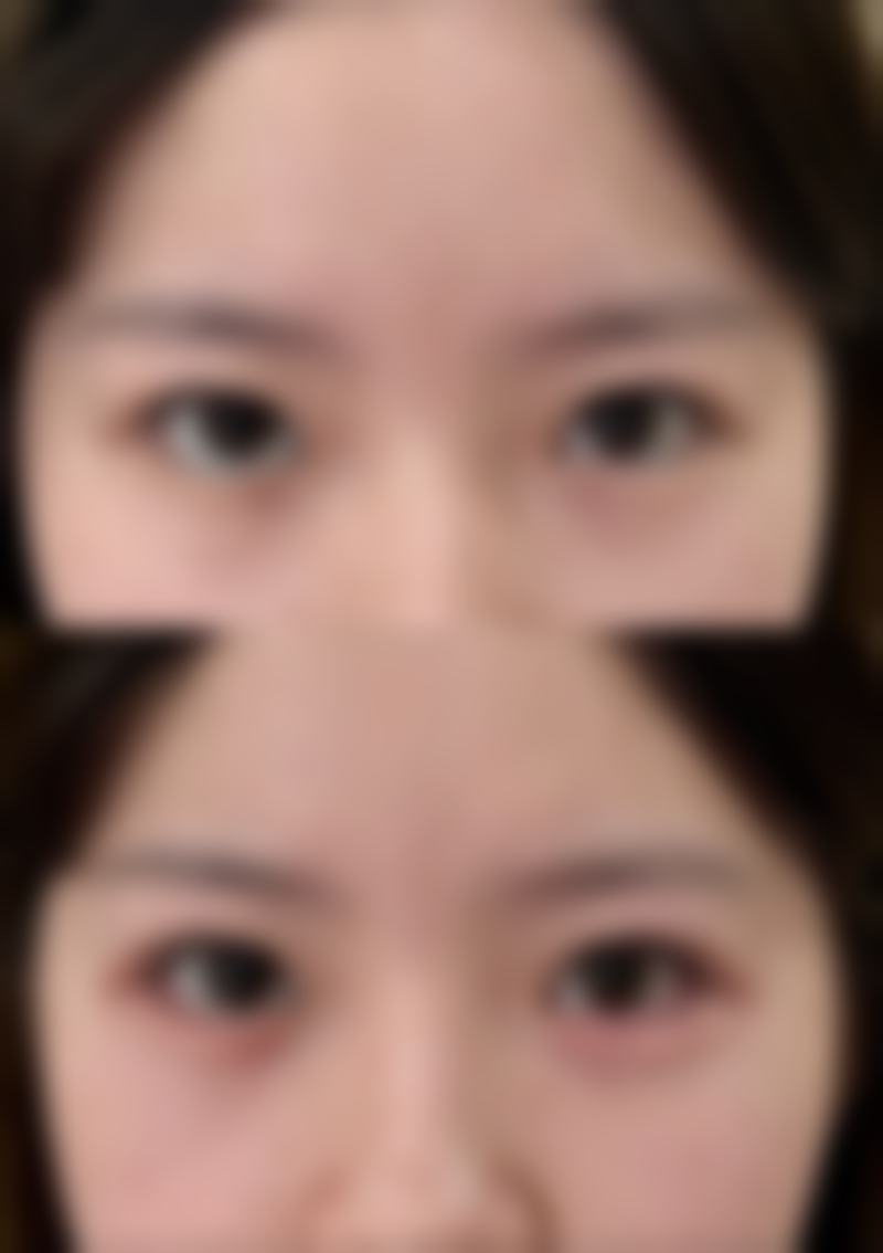 六、诸暨市人民医院(整形外科)怎么预约: