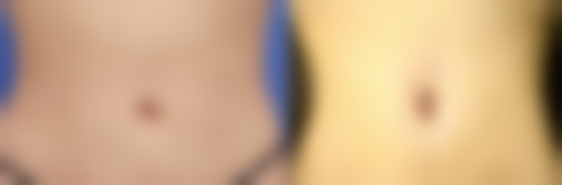 三、株洲市一医院烧伤整形外科医生介绍