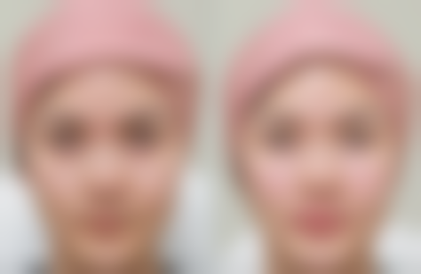 六、德阳金荣医学美容价格表：（仅供参考）