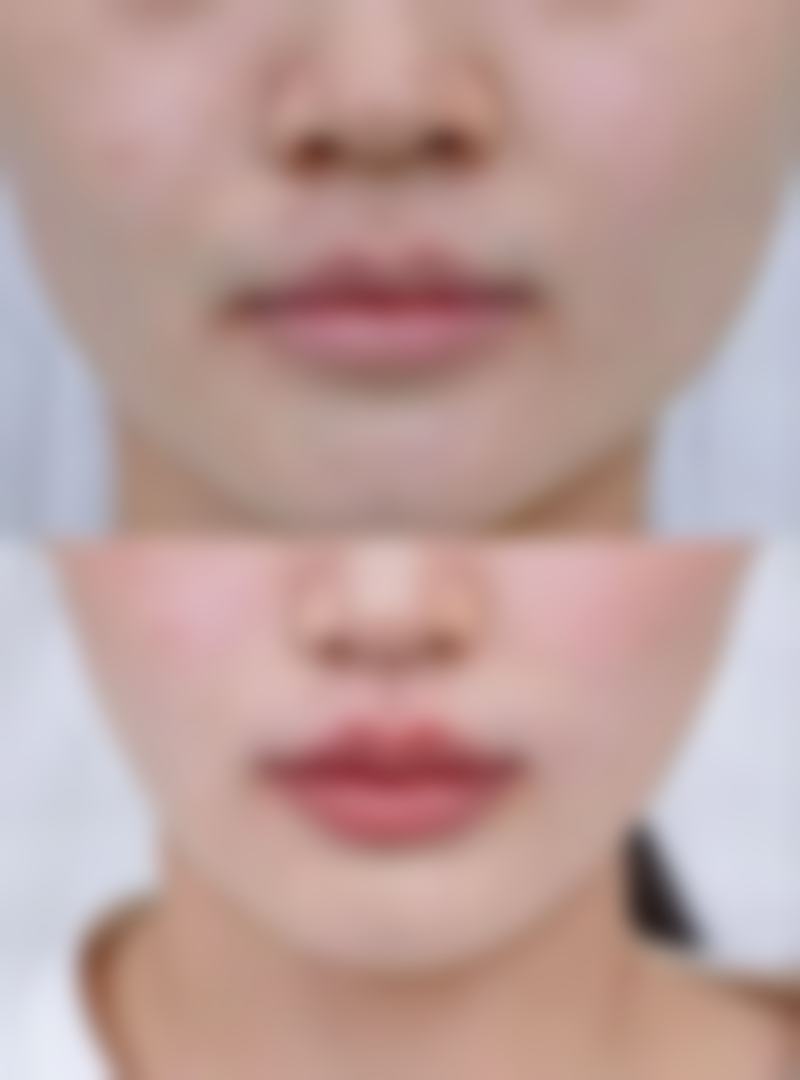 苏开新医生怎么预约?