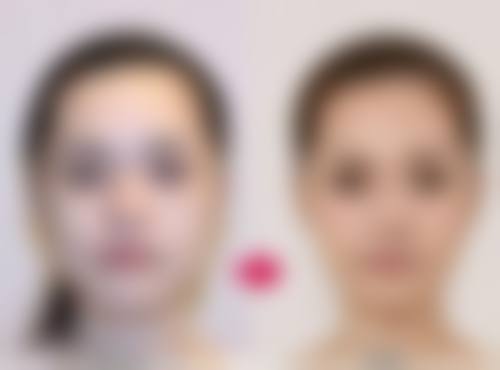 五、深圳可丽雅医疗美容医院实例