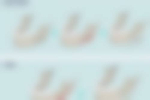 怎样安全丰太阳穴？玻尿酸与自体脂肪填充，低排异创伤小效果自然持久！ 