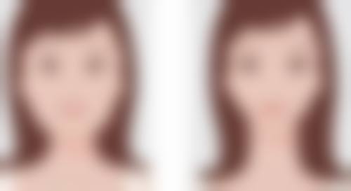 怎样安心丰太阳穴？选择正规机构的重要性