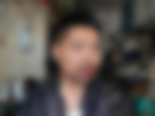 武春燕医生毛发移植实例