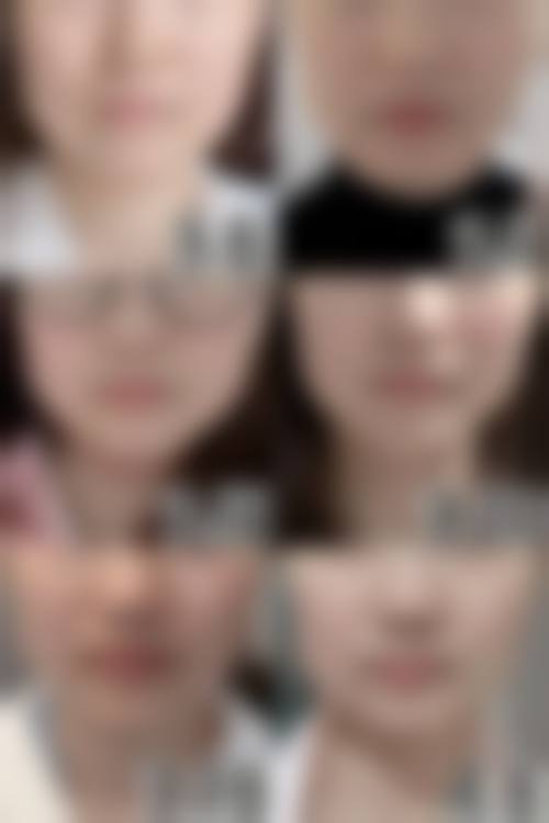 武春燕医生毛发移植怎么样可靠吗？