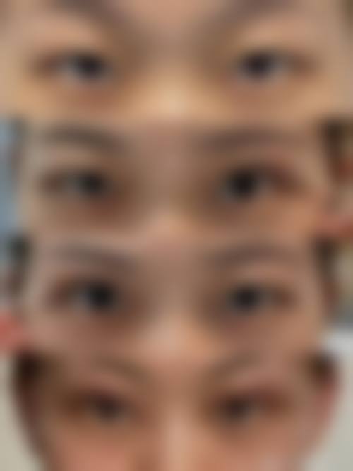 安延珠医生眼部整形怎么样可靠吗？