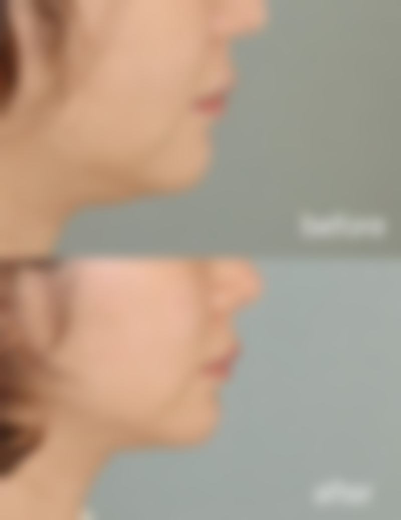 七、郑州二七区张朝蕾整形医院真实的顾客评价如下：