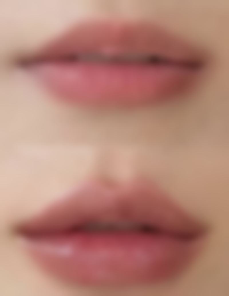 丰太阳穴存在的风险