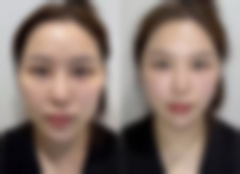 七、泰安市臻美外科整形医院真实的顾客评价如下：