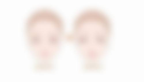 瘦脸针半月未见效，治疗后护理，保持成效有诀窍