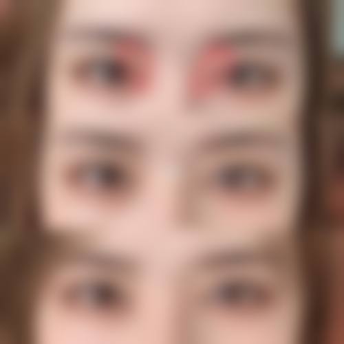 五、安庆宿松县中医院实例