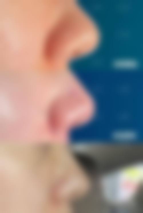 五、南通大学附属医院烧伤整形外科实例