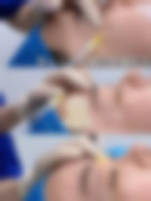 八、郑州刘少顺医疗美容诊所真实的顾客评价如下: