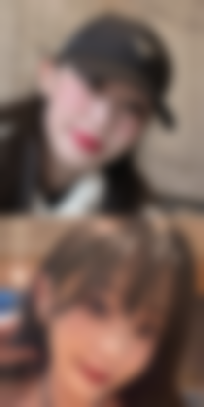 贺京石医生面部年轻化实例