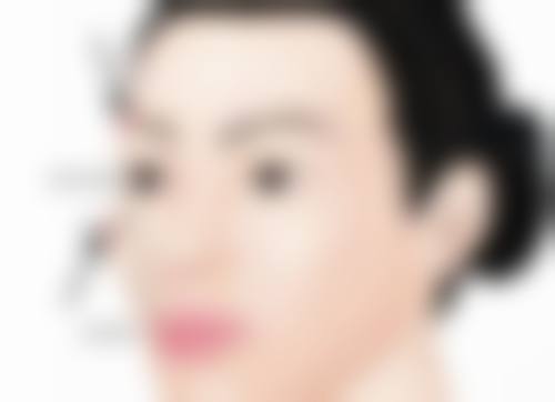 腰腹抽脂暗藏哪些伤害？脂肪栓塞危害大