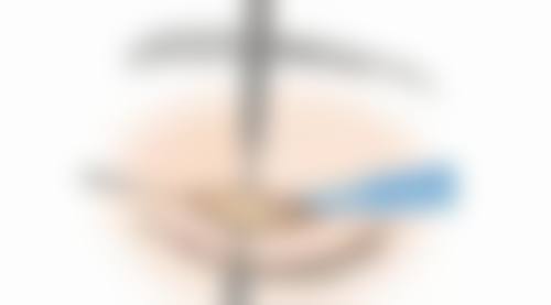 吸取教训长记性，合理饮食保健康