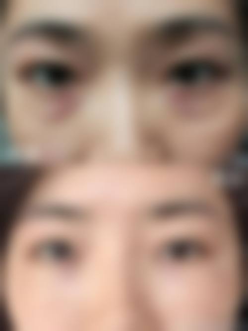 七、长沙米琪甄美整形医院真实的顾客评价如下: