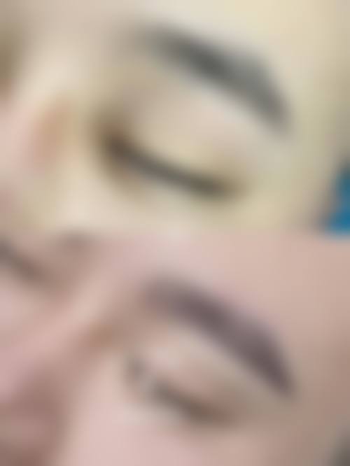 宋振宁医生毛发移植怎么样可靠吗？