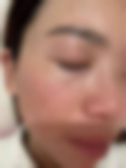 七、甲府SkinClinic价格表:(仅供参考)