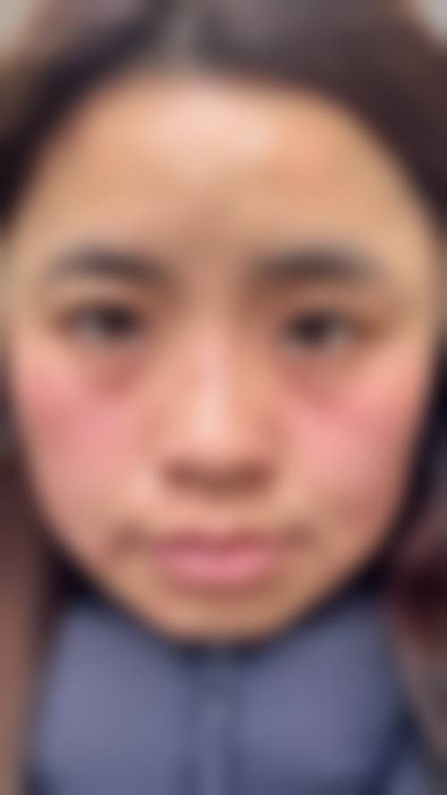 六、甲府SkinClinic怎么预约: