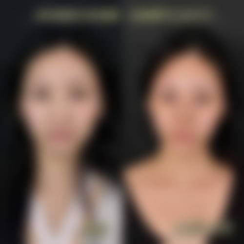 七、昆明鹏爱靓颜医疗美容门诊部价格表:(仅供参考)