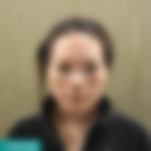 六、昆明鹏爱靓颜医疗美容门诊部怎么预约: