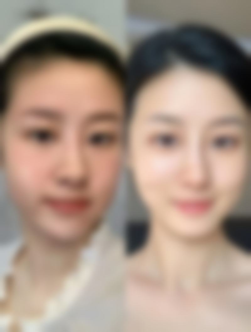 五、牡丹江赵桂荣中医皮肤整形科实例