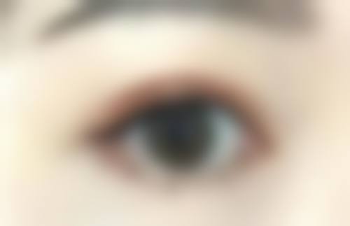 五、宁波市第六医院整形外科实例