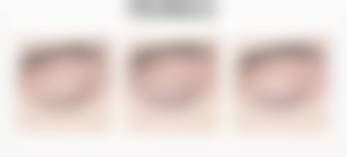 李学刚医生五官整形实例