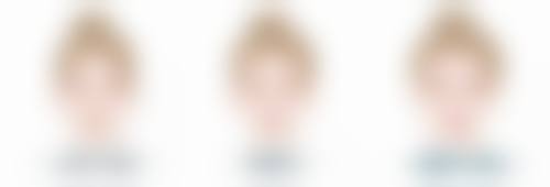 最近单眼皮变双眼皮意味着啥？可能暗示一些健康状况