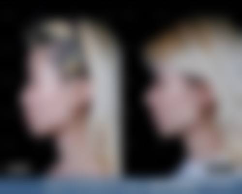 八、广西柏琳悦美医疗美容门诊部真实的顾客评价如下: