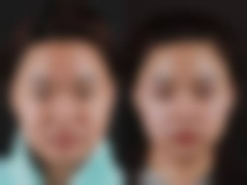 八、邢台博爱医院整形科真实的顾客评价如下: