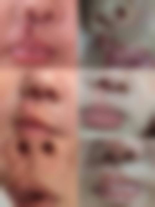 二、深圳千羽医院疤痕整形科正规吗？来看看医院资质：