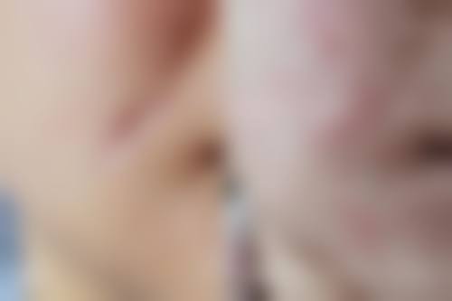 八、深圳千羽医院疤痕整形科真实的顾客评价如下：